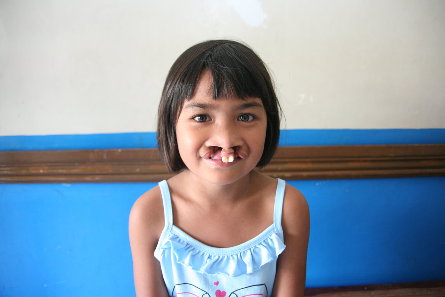 Neponset Valley Oral and Maxillofacial Surgery Associates | Dental Implants, Cleft Lip Palate and Wisdom Teeth