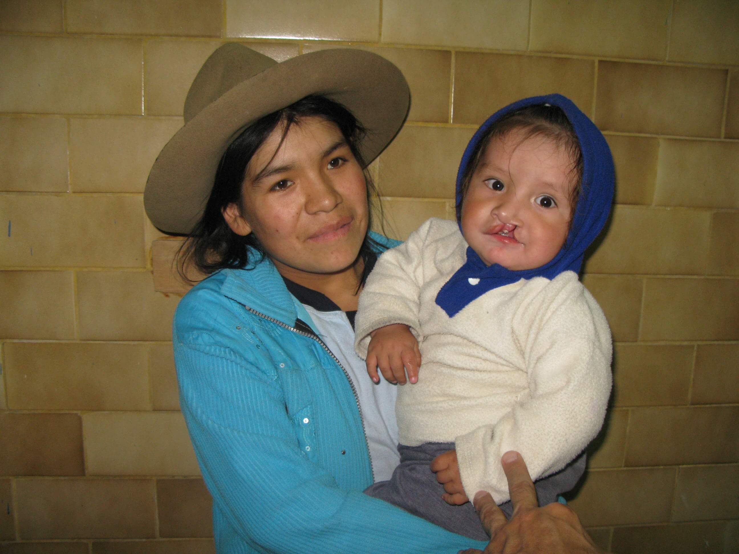 Neponset Valley Oral and Maxillofacial Surgery Associates | Surgical Exposure, TMJ Disorders and Wisdom Teeth